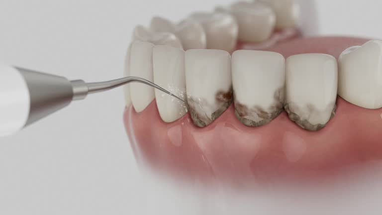 Reliable Dental contractor in Lac du Flambeau, WI by Dentist Open Now